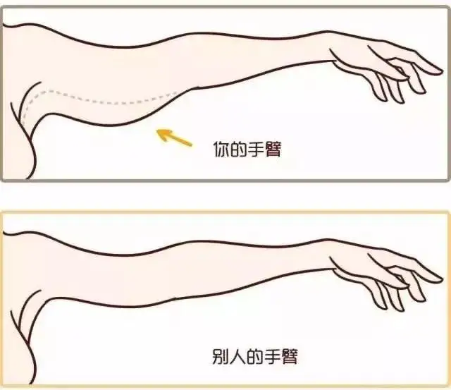 赛乐赛